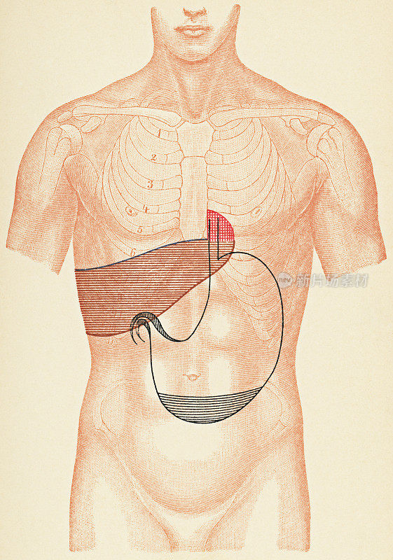 人体躯干与叩诊点的医学说明为病人幽门狭窄，正面视图- 19世纪
